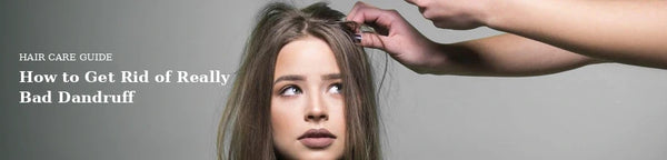 how to get rid of really bad dandruff